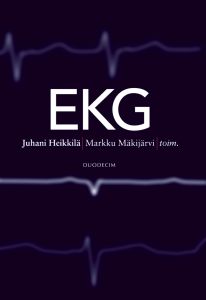 EKG
