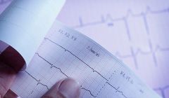 EKG ja johtumishäiriöt