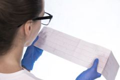 EKG:n perusteet