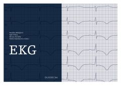 EKG