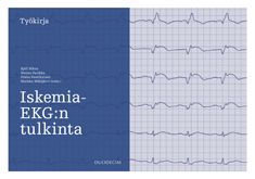 Siirry tuotesivulle Iskemia-EKG:n tulkinta