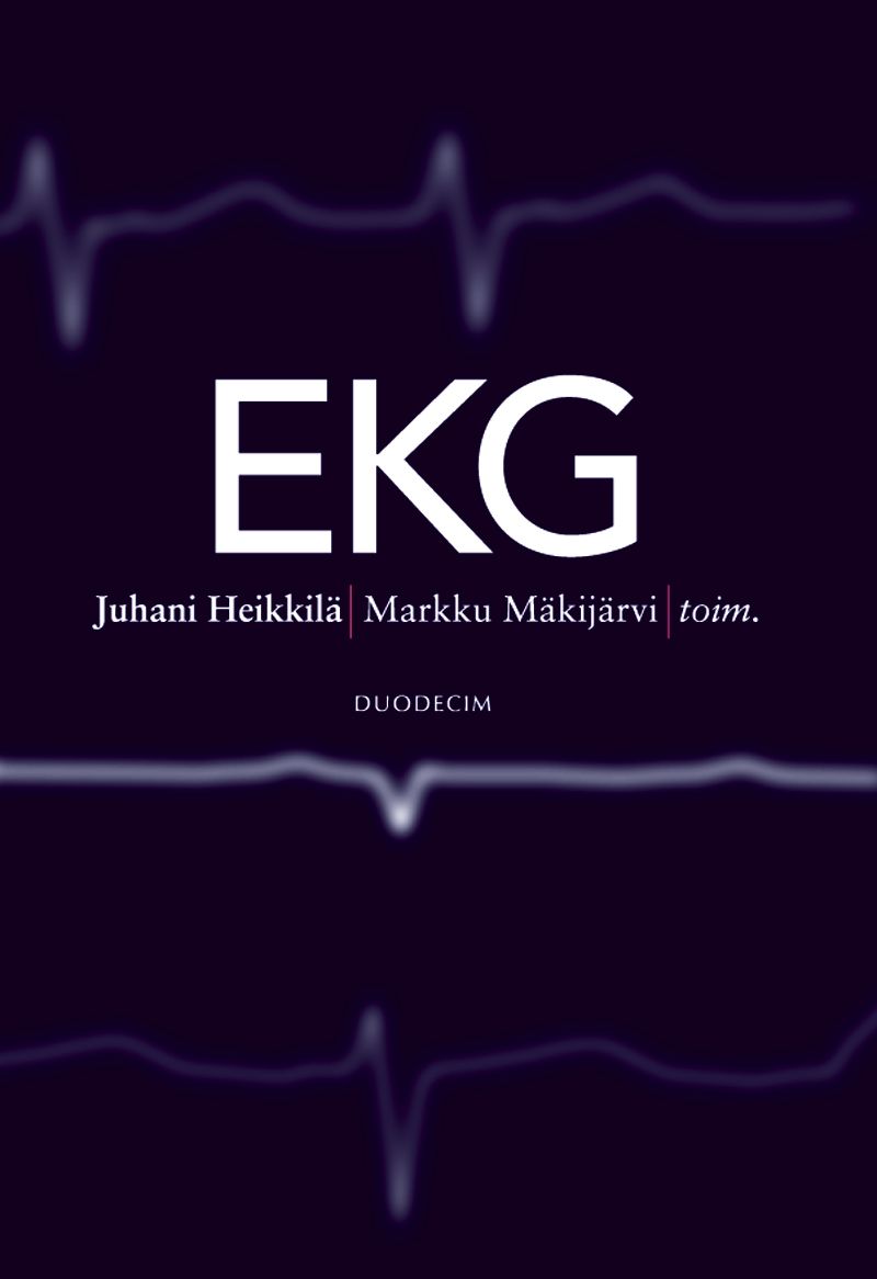 EKG
